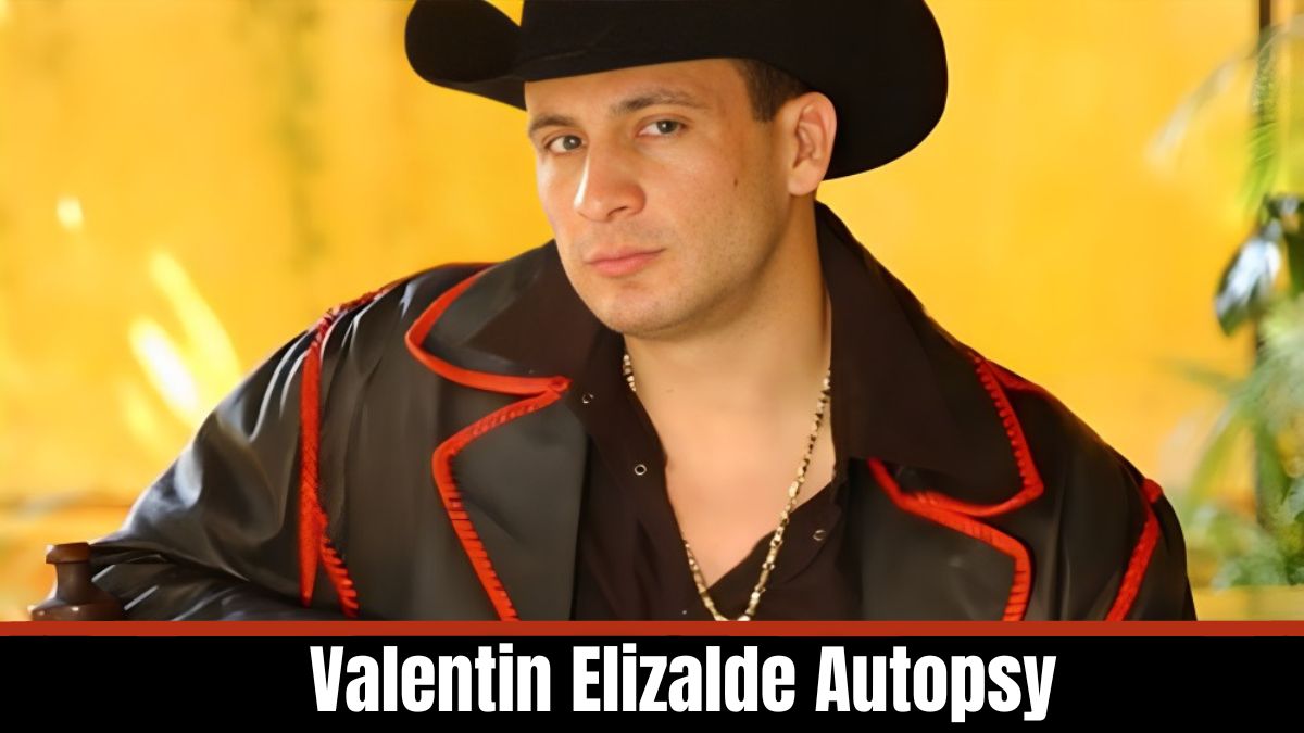 Valentin Elizalde Autopsy Uncovering The Mystery Behind His Death
